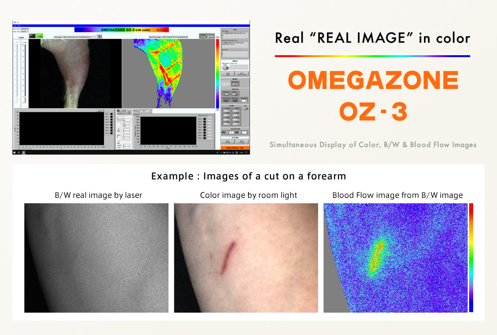 OMEGAZONE OZ-3 Simultaneous Display of Color, B/W & Blood Flow Images 