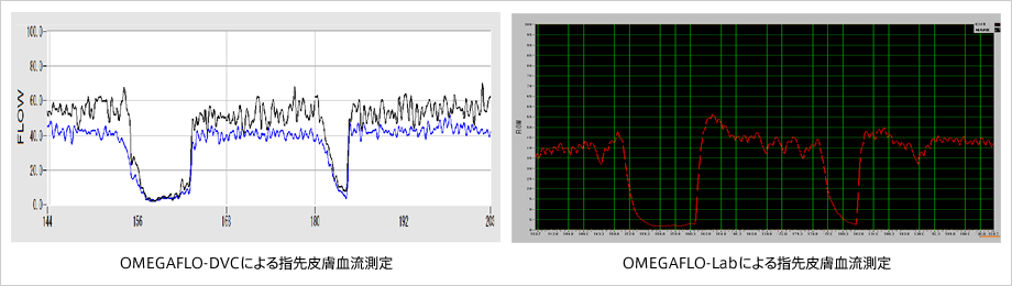 Fig. 4　指先血流の比較測定